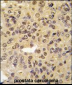 MEN1 Antibody (S128)